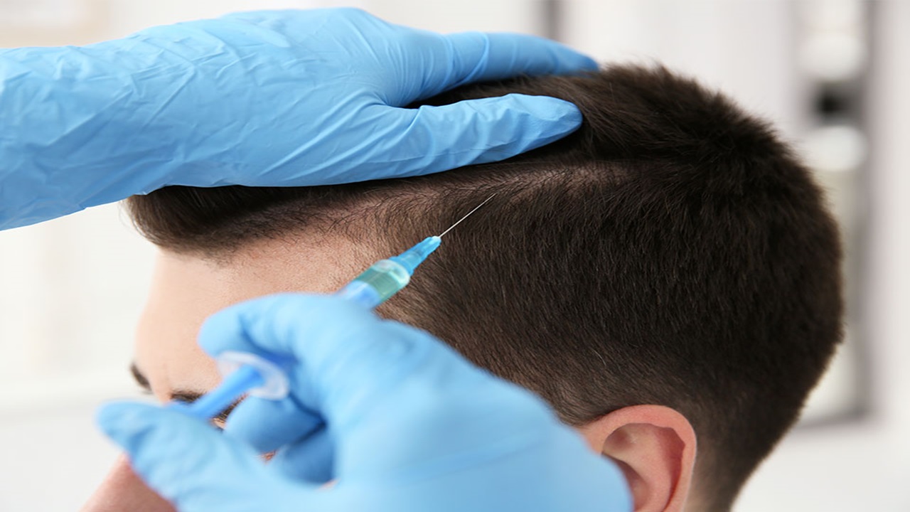 Ankara Saç Kök Hücre Tedavisi ile İstediğiniz Saçlara Sahip Olun